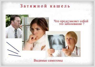 Лечение сухого кашля у взрослого