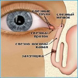 Гноятся глаза у ребенка чем лечить народными средствами