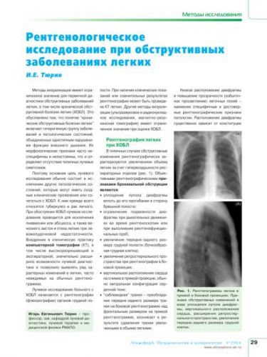 Виды рентгена при пневмонии у детей и примеры снимков