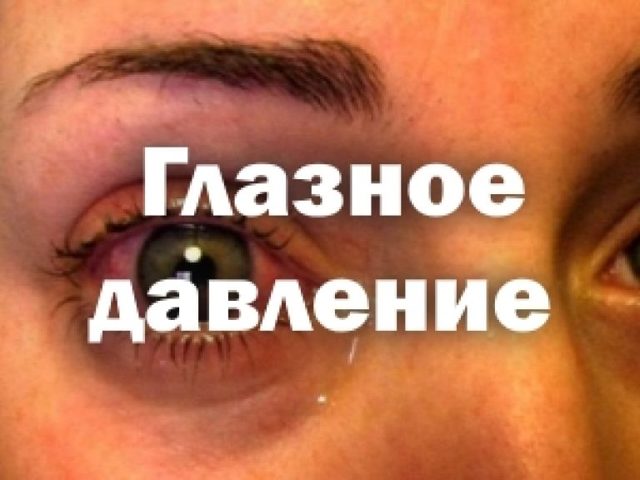 Если внутриглазное давление в норме может ли быть глаукома