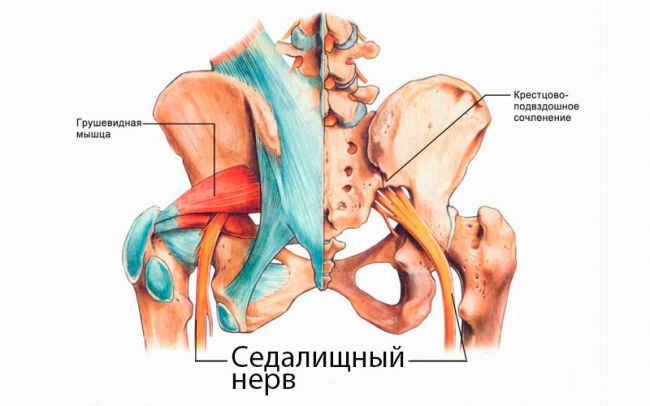 Если защемило нерв в спине, что делать