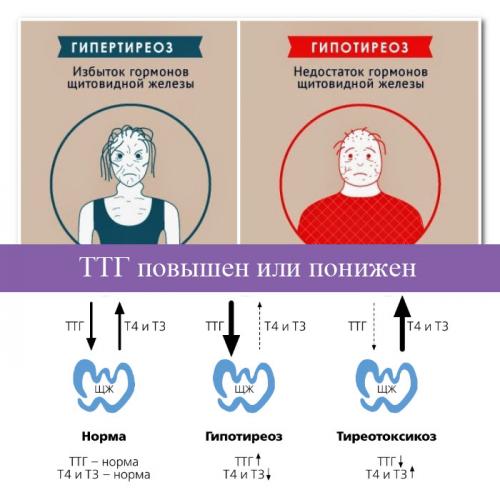 Функциональность щитовидной железы ттг, т3 и т4