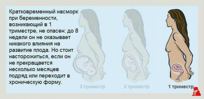 Чем лечить насморк при беременности: 1 триместр