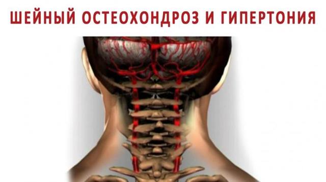 Лучшие упражнения при шейном остеохондрозе: самые эффективные и простые комплексы лфк