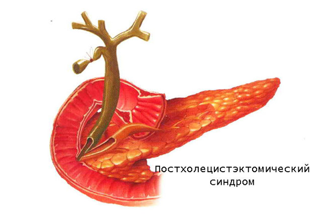 Диета для восстановления желудка и кишечника, меню на неделю