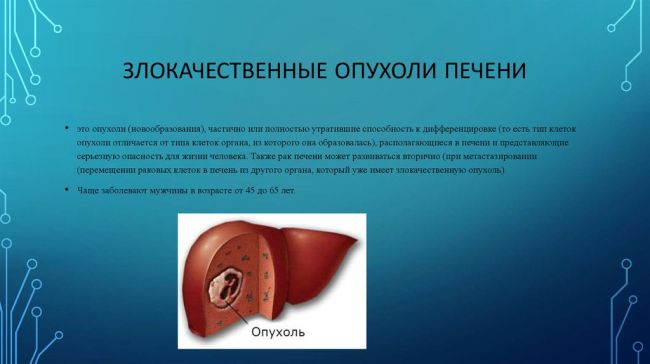 Диагностика и лечение кавернозной гемангиомы печени