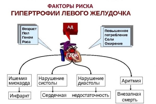 Гипертрофия левого желудочка сердца – чем опасна патология, как ее выявить и лечить?