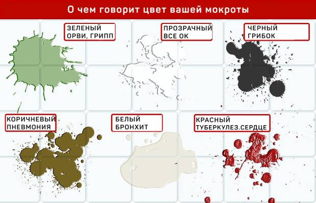 Что означает появление зеленой мокроты при кашле у взрослых и детей?