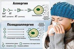 Аллергия на алкоголь: симптомы у взрослых и как избавиться от аллергии на пиво, вино, водку и другие напитки