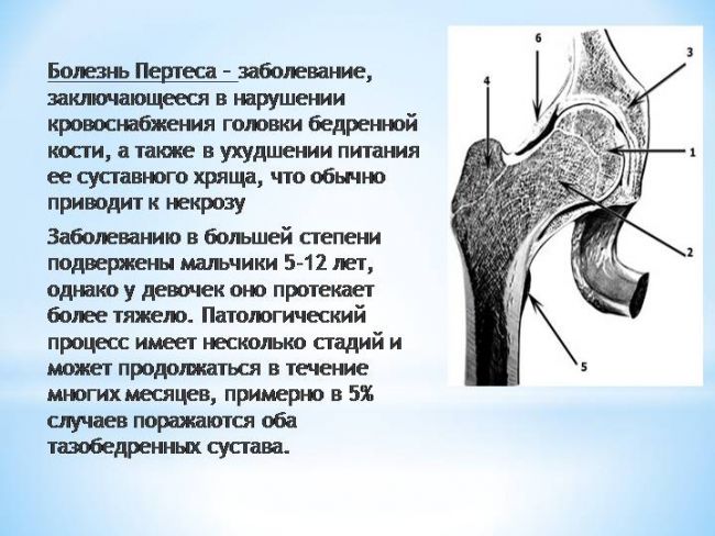 Болезнь пертеса у собак