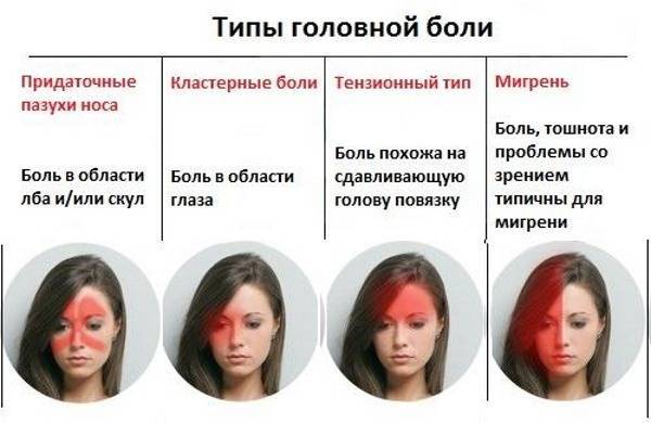 Лекарства от сильной головной боли