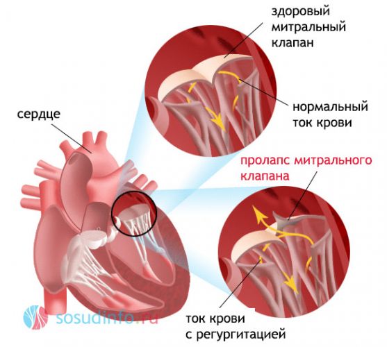 Клиническая эхокардиография