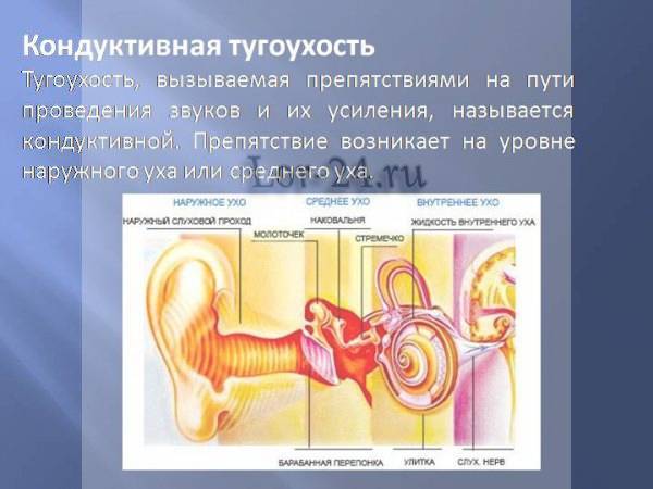 Тугоухость и глухота - причины, виды (нейросенсорная, кондуктивная, смешанная, наследственная), степени, симптомы, лечение. особенности тугоухости и глухоты у детей.
