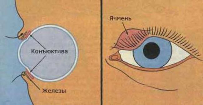 Чешутся глаза и опухают веки: причины, шелушится веко, почему