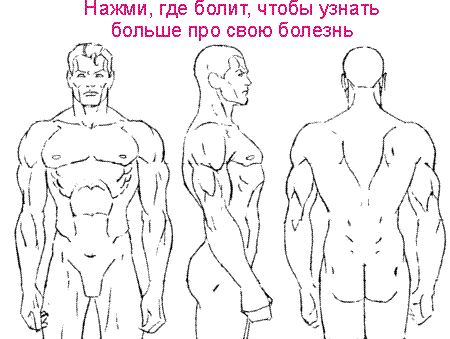 Лучшие таблетки от остеохондроза шейного отдела позвоночника