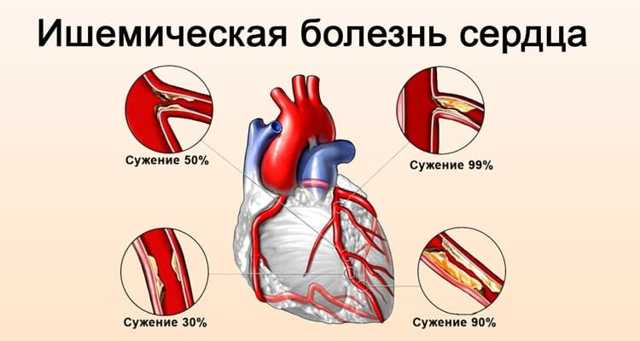 Влияние кальция на организм человека – польза и вред