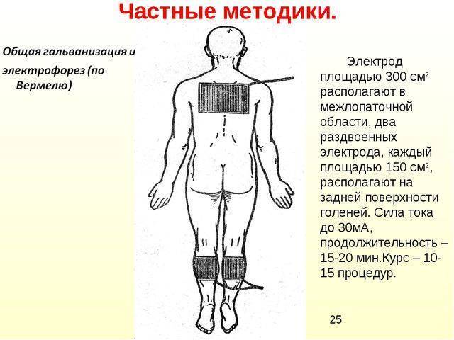 Электрофорез с хлористым кальцием при бронхите