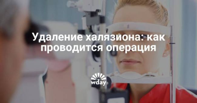 Лечение халязиона у детей – причины, как и чем лечить без операции