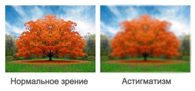 Астигматизм: как правильно подобрать очки?