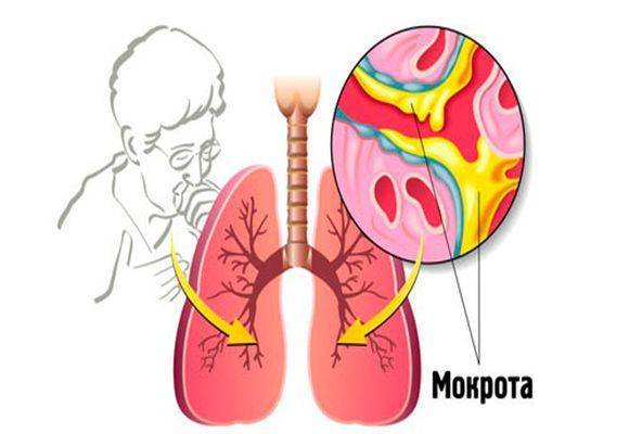 Мокрота с кровью при кашле