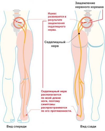 Защемление нерва в позвоночнике: симптомы и методы лечения | все о суставах и связках