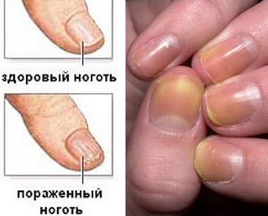 О чем говорит цвет ногтей на руках