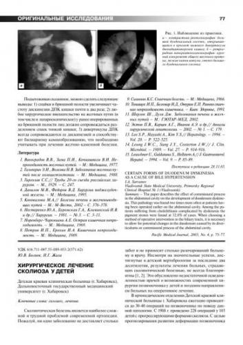 Спаечная болезнь кишечника: что это такое и как с этим бороться