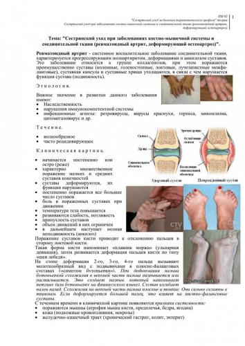 Как лечить остеоартрит коленного сустава?