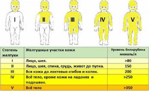 Продукты повышающие билирубин при синдроме жильбера
