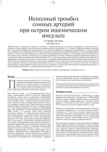 Расслоение сонной артерии: патофизиология, причины, диагностика, лечение