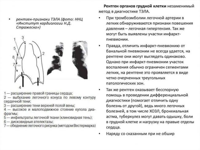 Рентген легких: показания к проведению, оценка вредности и особенности процедуры