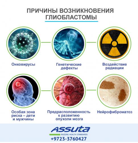 Олигодендроглиома головного мозга: симптомы, лечение и прогноз