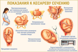 Какие должны быть выделения после родов?