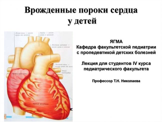 Врожденные пороки сердца (впс) у детей: причины, симптомы, диагностика и лечение