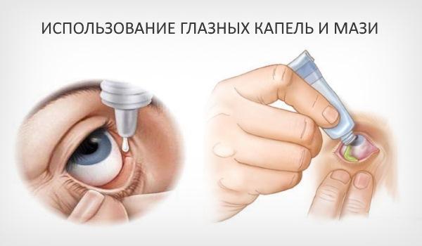 Как избавиться от ячменя на глазу в домашних условиях