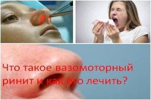 Вазомоторный ринит: лечение народными средствами в домашних условиях