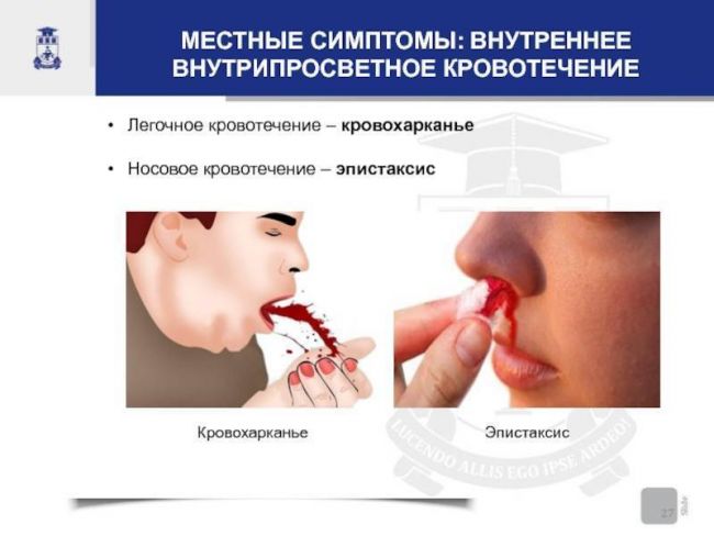Кровь при кашле в мокроте при пневмонии у взрослых