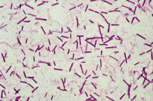 Escherichia coli в посеве на флору у женщин при беременности