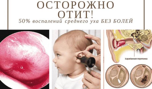 Причины и симптомы отита, как его лечить?