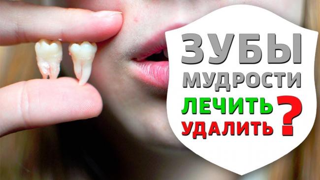 Удаление зуба мудрости и рекомендации после удаления