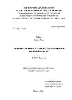 Лапароцентез
