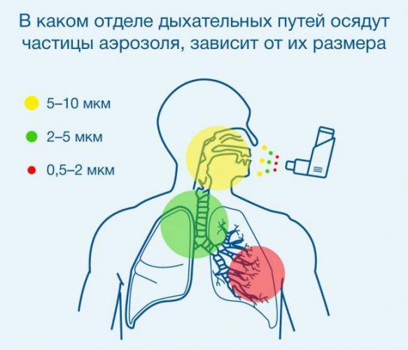 Ингаляции при астме — эффективный способ лечения заболевания