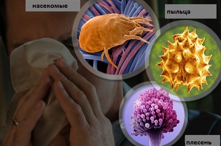 Аллергический насморк — симптомы и лечение у взрослых и детей, препараты