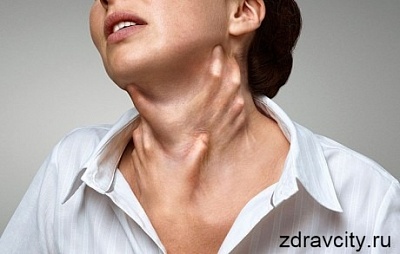 Крапивница причины появления