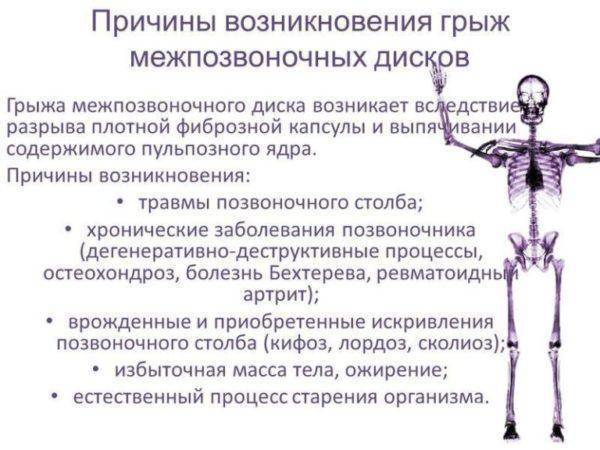 Как лечить грыжи и протрузии позвоночника?