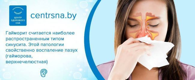 Прокол при гайморите