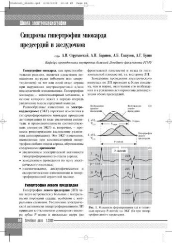 Гипертрофия правого желудочка на экг: что это такое, причины и симптомы, лечение и прогноз жизни