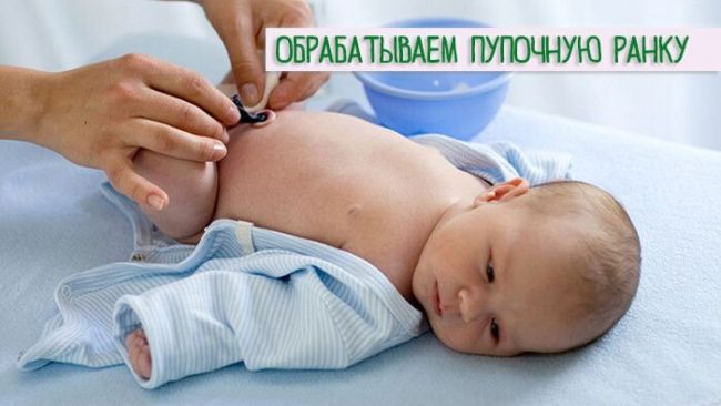 Кровит пупок у новорожденного