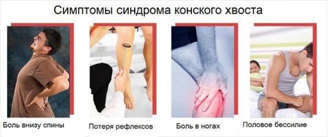 Как лечить грыжи и протрузии позвоночника?
