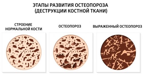 Бивалос: инструкция по применению